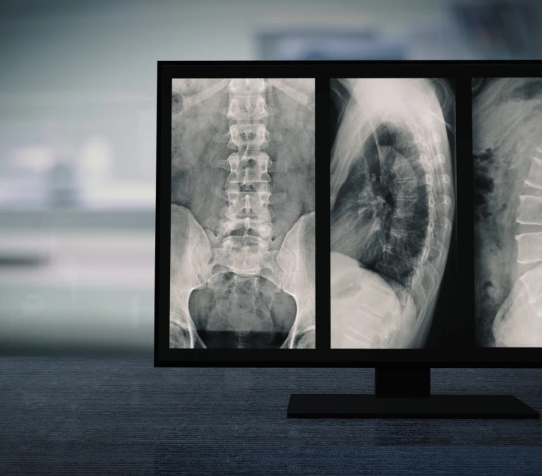 zdjęcia rendgenowskie