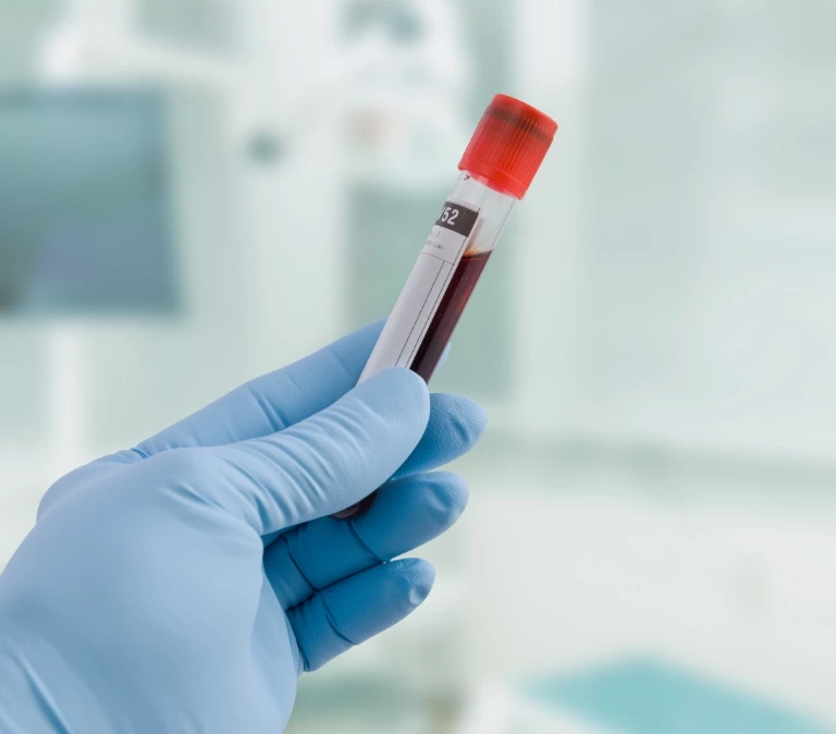 próbka krwi w&nbsp;dłoni